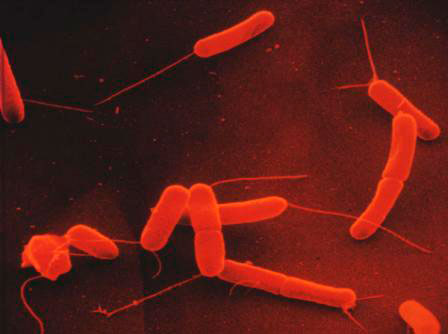 Escherichia coli (ETEC)
