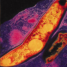 Mycobacterium